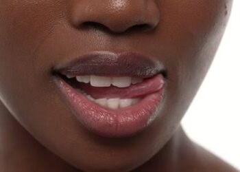 Yawan lashe leɓɓa da harshe na kawo cuta da yi wa leɓɓa lahanin gaske – Likita